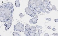 Anti-BCRP (ABCG2) Antibody, clone 10K5 , ZooMAb� Rabbit Monoclonal 