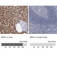 Anti-BDH1 antibody produced in rabbit 