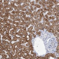 Anti-BDH1 antibody produced in rabbit