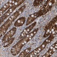 Anti-BDH2 antibody produced in rabbit 