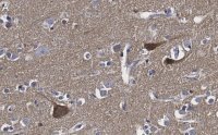 Anti-BDNF Antibody, clone 1I14 ZooMAb� Rabbit Monoclonal 
