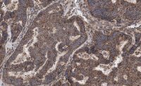 Anti-Beclin 1 Antibody, clone 1E22 , ZooMAb� Rabbit Monoclonal 