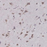 Anti-BEND6 antibody produced in rabbit