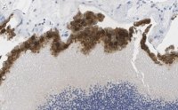 Anti-Bestrophin-1 Antibody, clone E6-6 ZooMAb� Mouse Monoclonal 