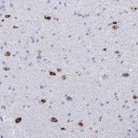 Anti-BEX5 antibody produced in rabbit 