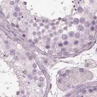 Anti-BFSP1 antibody produced in rabbit 
