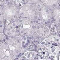 Anti-BFSP2 antibody produced in rabbit