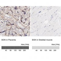 Anti-BGN antibody produced in rabbit 