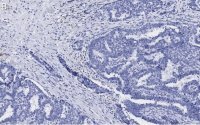 Anti-BIM Antibody, clone 2O18, ZooMAb® Rabbit Monoclonal