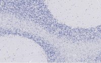 Anti-Bin1 Antibody, clone 99D.2 ZooMAb� Mouse Monoclonal 
