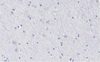 Anti-BLBP/FABP7 Antibody, clone 7I23, ZooMAb� Rabbit Monoclonal 