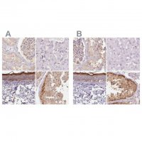 Anti-BLMH antibody produced in rabbit 