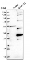 Anti-BLOC1S6 antibody produced in rabbit 