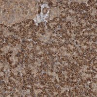 Anti-BLZF1 antibody produced in rabbit HPA025703-100UL
