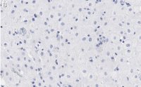 Anti-BMI-1 Antibody, clone F6 ZooMAb� Mouse Monoclonal 