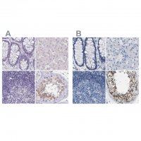 Anti-BOLL antibody produced in rabbit