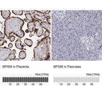 Anti-BPGM antibody produced in rabbit HPA028735-100UL