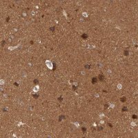 Anti-BRAF antibody produced in rabbit 
