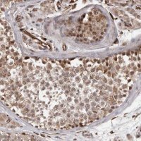 Anti-BRAT1 antibody produced in rabbit 