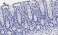 Anti-BRG1 Antibody, clone 1N12, ZooMAb� Rabbit Monoclonal 