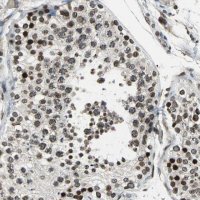 Anti-BRIP1 antibody produced in rabbit