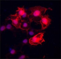 Anti-BRSK1 antibody produced in rabbit SAB4200392-200UL