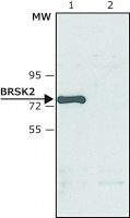 Anti-BRSK2 (N-terminal) antibody produced in rabbit SAB4200431-200UL