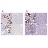 Anti-BSND antibody produced in rabbit 