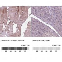 Anti-BTBD1 antibody produced in rabbit 