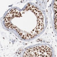 Anti-BUB3 antibody produced in rabbit