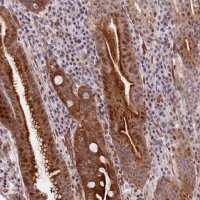 Anti-C10ORF11 antibody produced in rabbit 