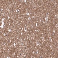 Anti-C10orf35 antibody produced in rabbit 