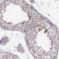 Anti-C10orf62 antibody produced in rabbit