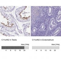 Anti-C11orf42 antibody produced in rabbit 