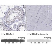 Anti-C11orf63 