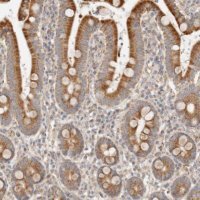 Anti-C12orf49 antibody produced in rabbit 