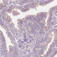 Anti-C1orf194 antibody produced in rabbit 