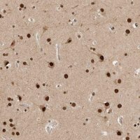 Anti-C1orf21 antibody produced in rabbit 