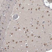 Anti-C1orf50 antibody produced in rabbit 