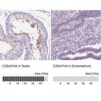 Anti-C20ORF144 antibody produced in rabbit 