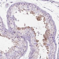 Anti-C20ORF144 antibody produced in rabbit 