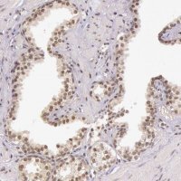 ANTI-C22orf29 antibody produced in rabbit HPA001419-100UL
