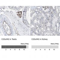 Anti-C22orf42 antibody produced in rabbit 