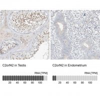 Anti-C2orf42 antibody produced in rabbit 