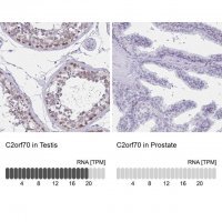Anti-C2orf70 antibody produced in rabbit 