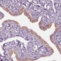 Anti-C2orf81 antibody produced in rabbit