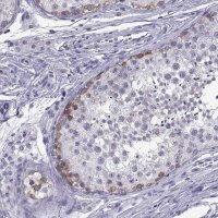 Anti-C3orf22 antibody produced in rabbit 