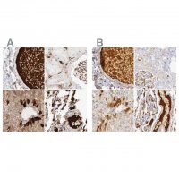 Anti-C4BPA antibody produced in rabbit 