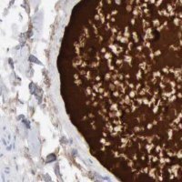 Anti-C4BPA antibody produced in rabbit 