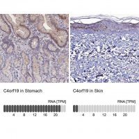 Anti-C4orf19 antibody produced in rabbit 